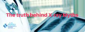 The truth behind X-ray myths